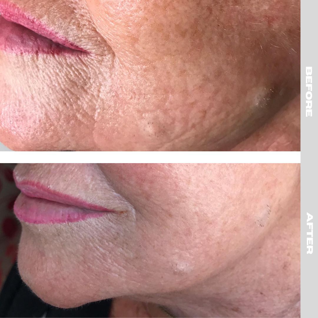 xr:d:DAFX76SPnnk:10,j:45351679916,t:23011716