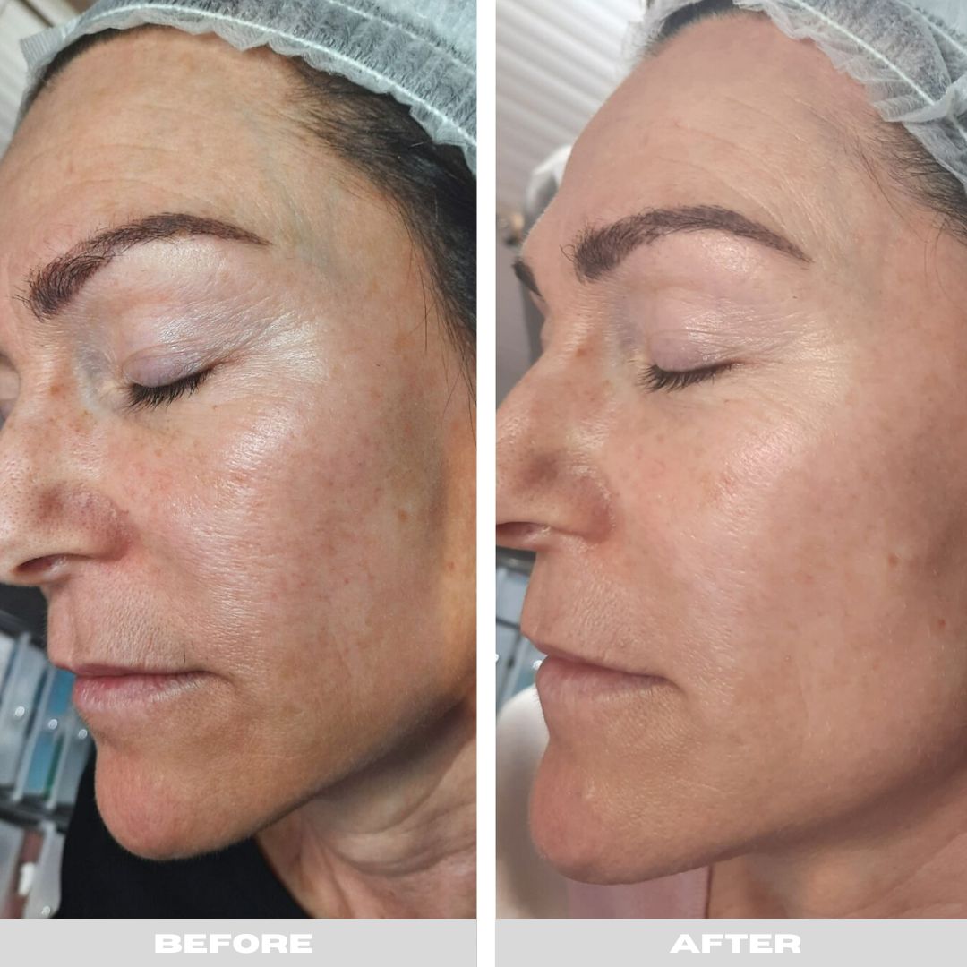 xr:d:DAFX76SPnnk:10,j:45351679916,t:23011716